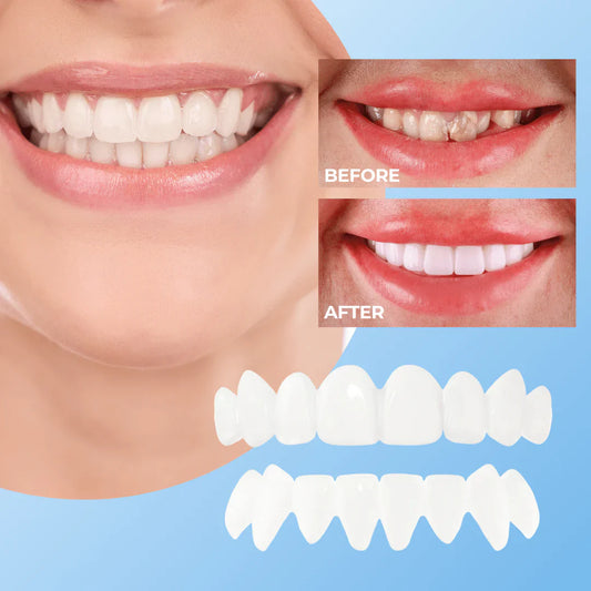 Clip-On Teeth-Veneers